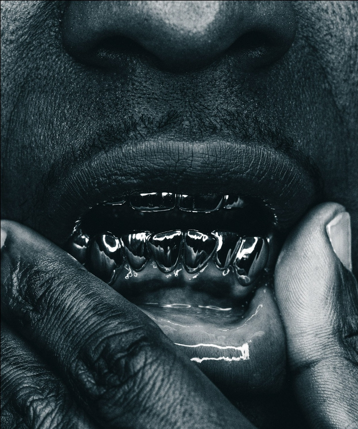 Custom grillz by Dusaint Duvel