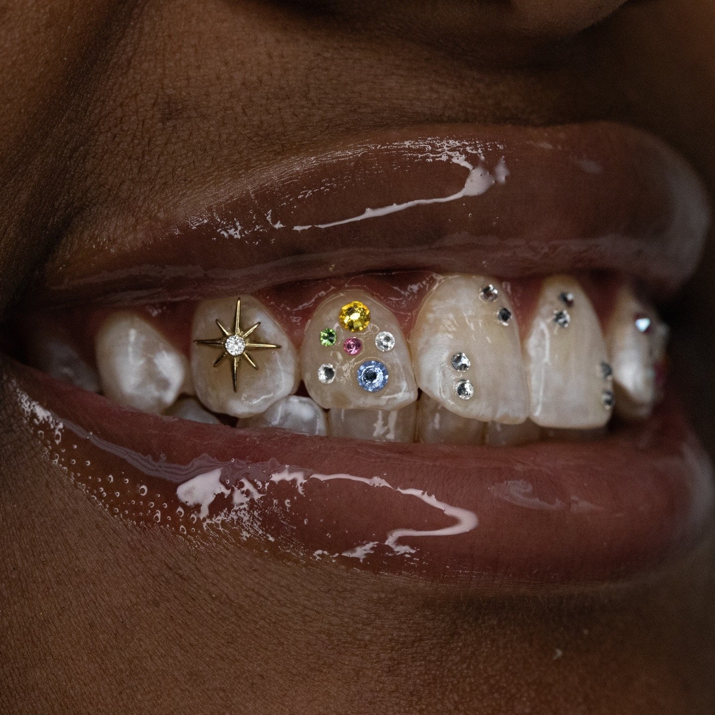 Custom tooth gems by Dusaint Duvel