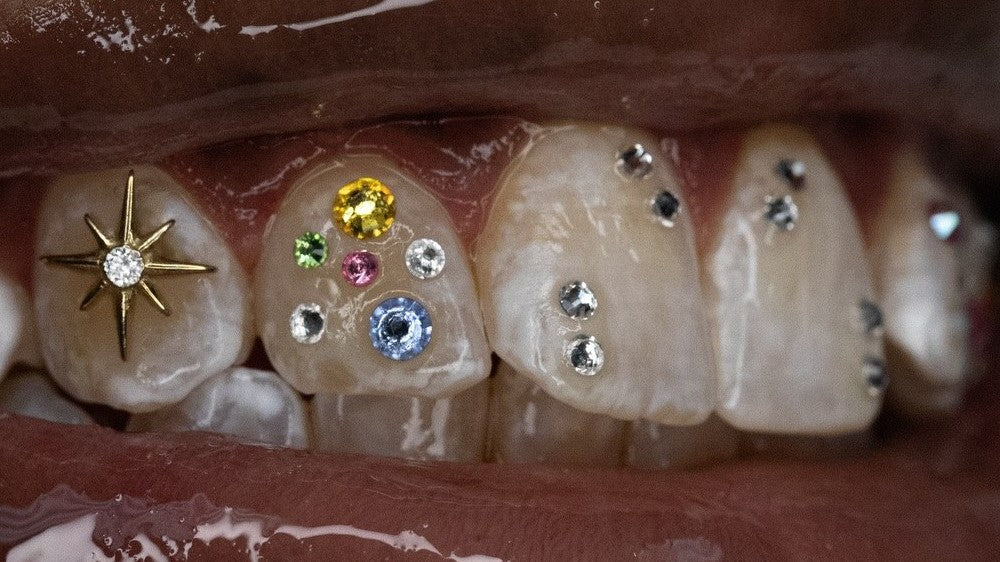 Custom tooth gems